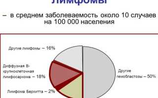 Лимфома  Беркитта её стадии и способы лечения