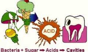 Причины зубного камня