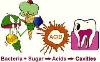 Причины зубного камня