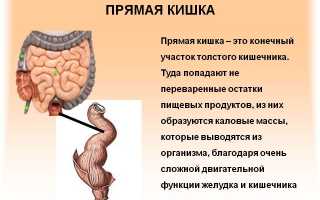 Особенности лечения бластомы прямой кишки