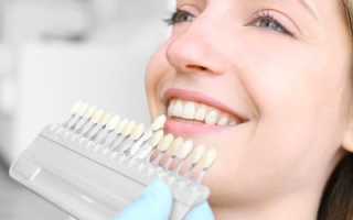 Как добиться улыбки, приковывающей взгляды? Самые лучшие способы отбеливания зубов