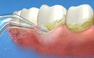 Поддержит здоровье зубов: обзор разных моделей ирригаторов для полости рта