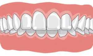 Неправильный вид челюсти легко поправим! Исправление прикуса