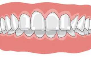 Неправильный вид челюсти легко поправим! Исправление прикуса