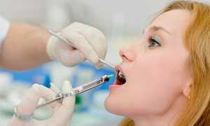 Методы лечения пульпита зубов: биологический и хирургический