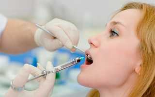 Методы лечения пульпита зубов: биологический и хирургический