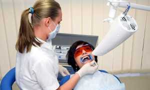 Фотоотбеливание