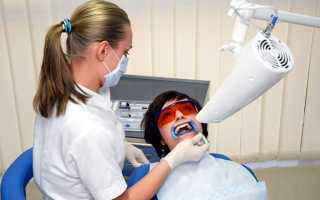 Фотоотбеливание