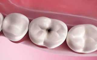 Такое разнообразие видов одного заболевания! Редкие формы пульпита: какие самые необычные?