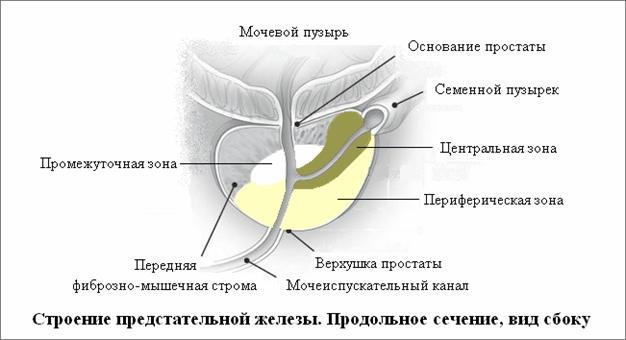Рак простаты