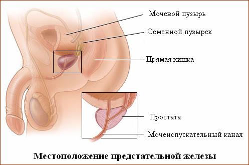 Чем лечить аденому простаты у мужчин?