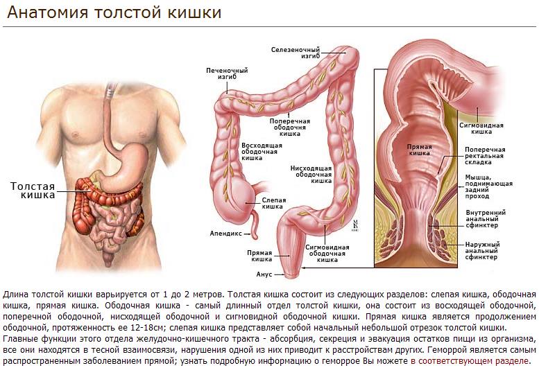 Опухоль толстой кишки