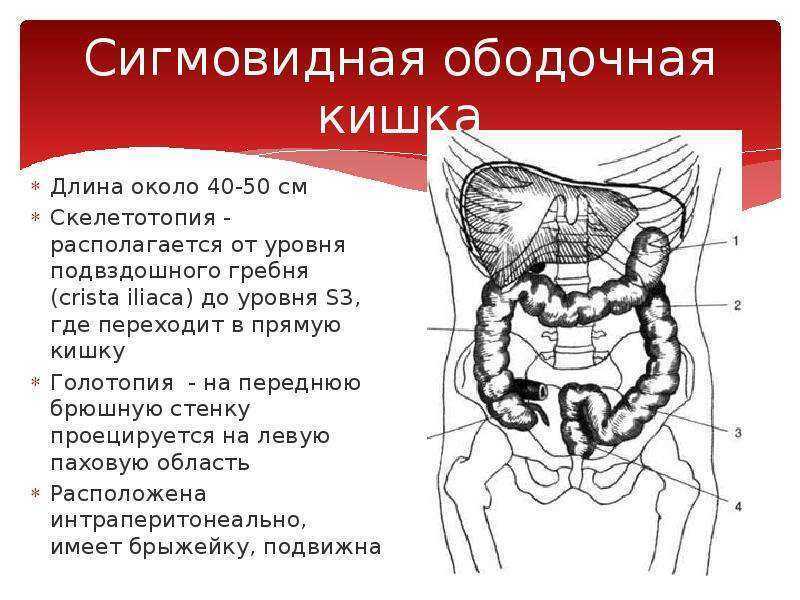 Что такое бластома сигмовидной кишки?