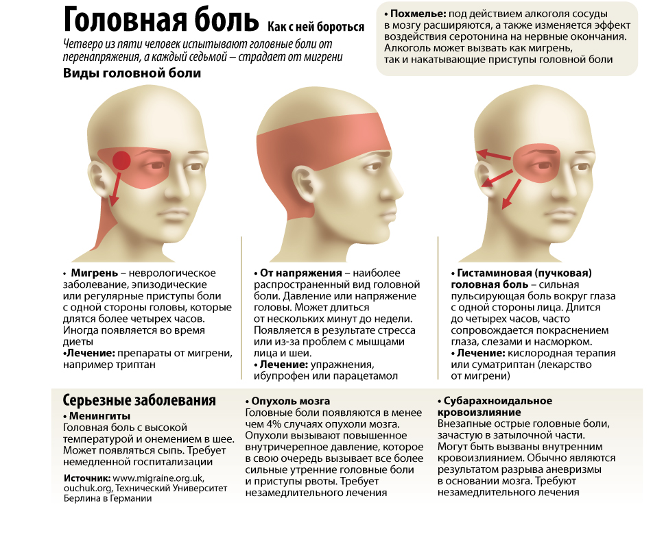 Головная боль