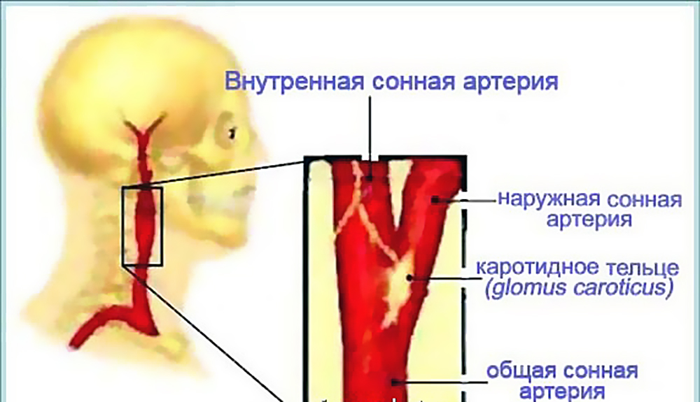 Опухоль шеи