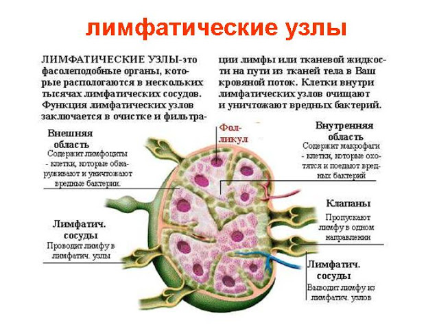 Опухоль лимфатических узлов