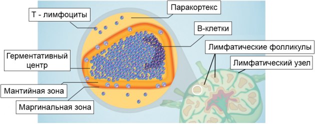 Лимфома из клеток мантийной зоны