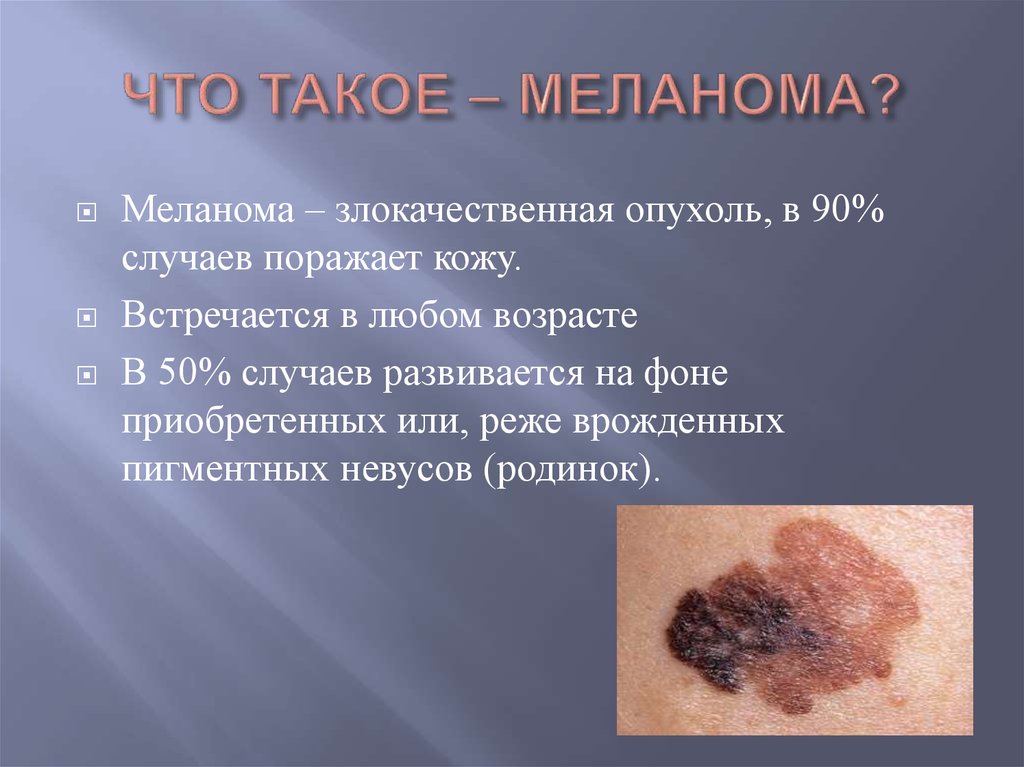 Родинка или меланома?
