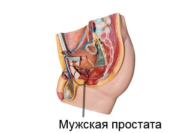 Аденома простаты 2 степени
