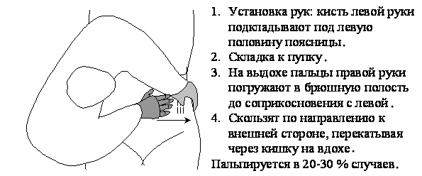 диагностика опухли ободочной кишки