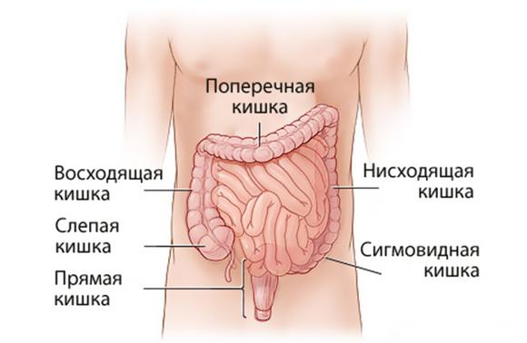 Опухоль сигмовидной кишки