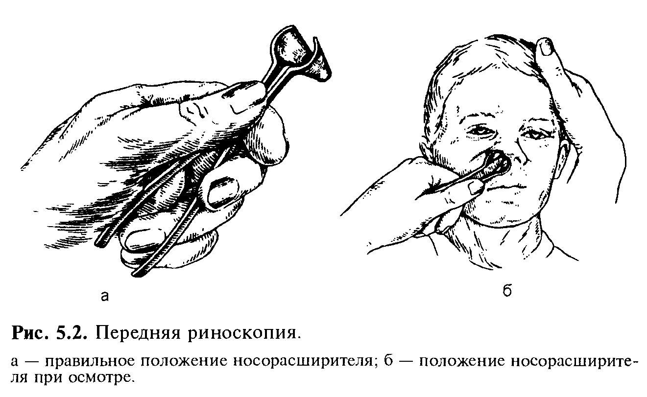 Диагностика рака носа