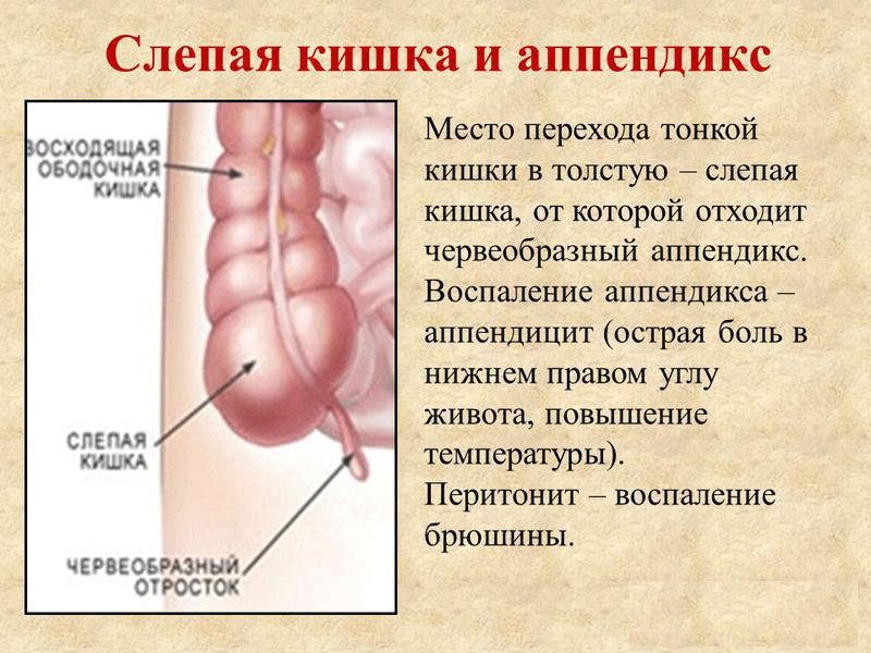 Бластома слепой кишки
