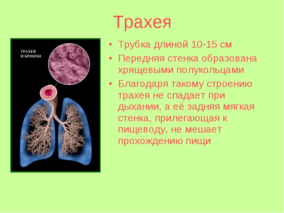 Опухоль трахеи