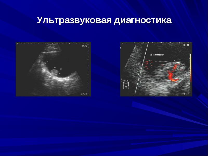Диагностика злокачественных опухолей