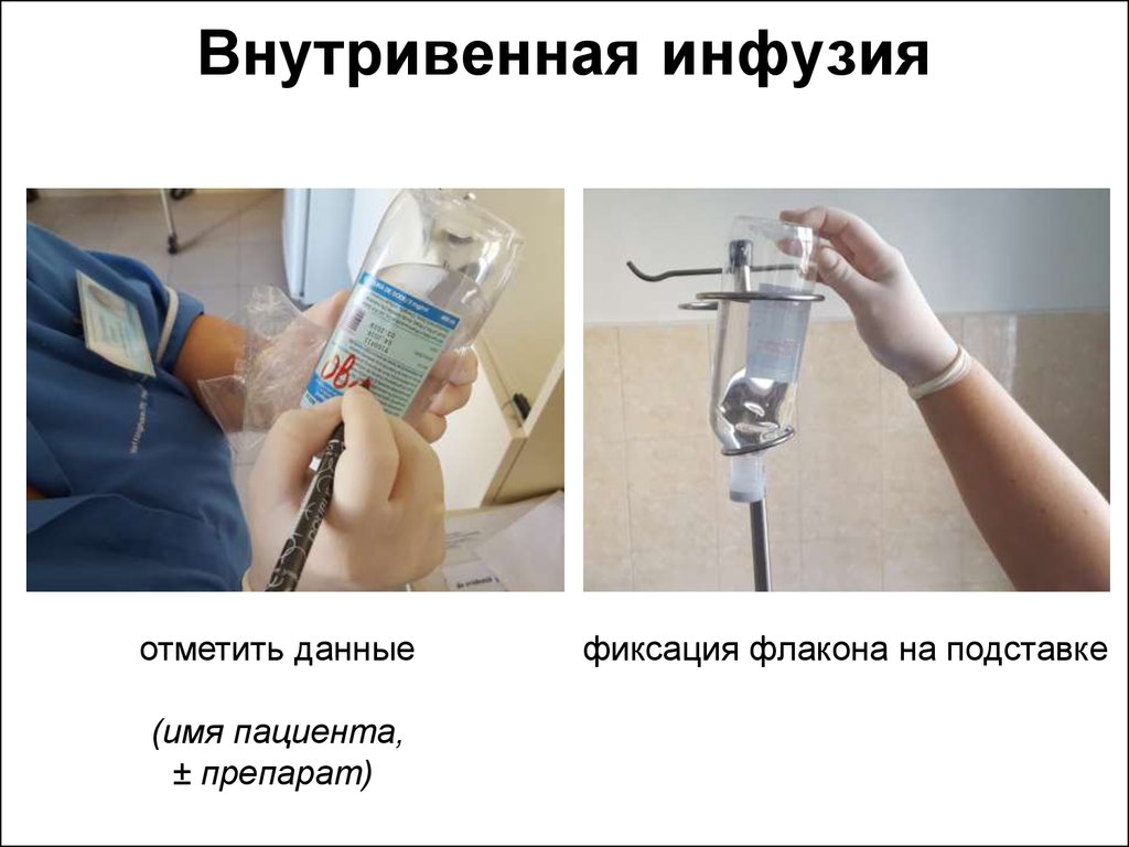 Ифосфамид - инструкция по использованию