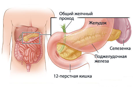 Рак поджелудочной железы.Симптомы