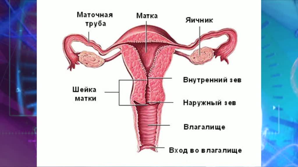 Фиброма влагалища