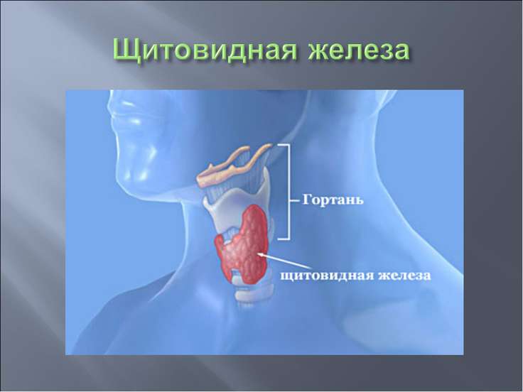 Карцинома щитовидки