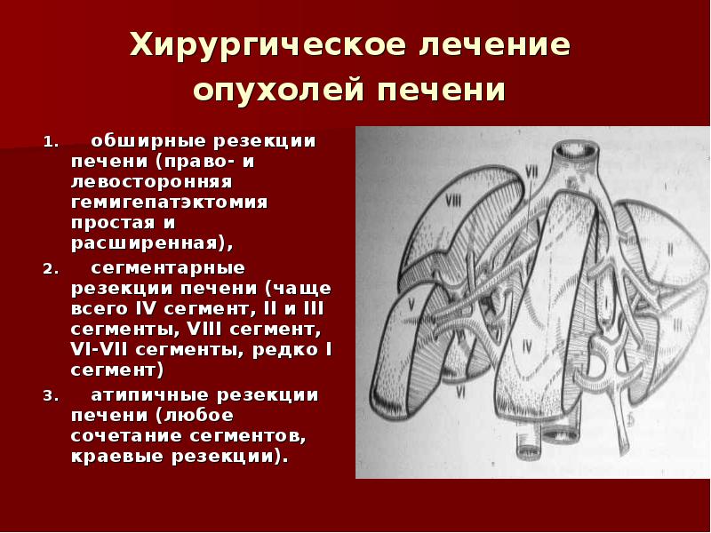 Гепатоцеллюлярная аденома печени