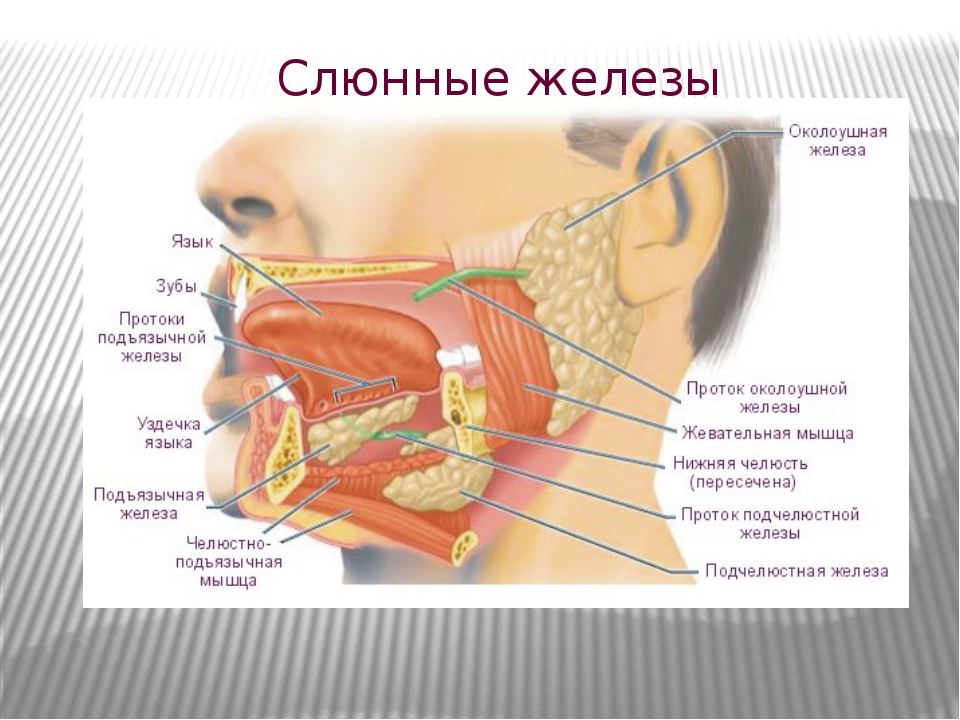 Плеоморфная аденома околоушной слюнной железы