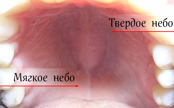 Рак неба