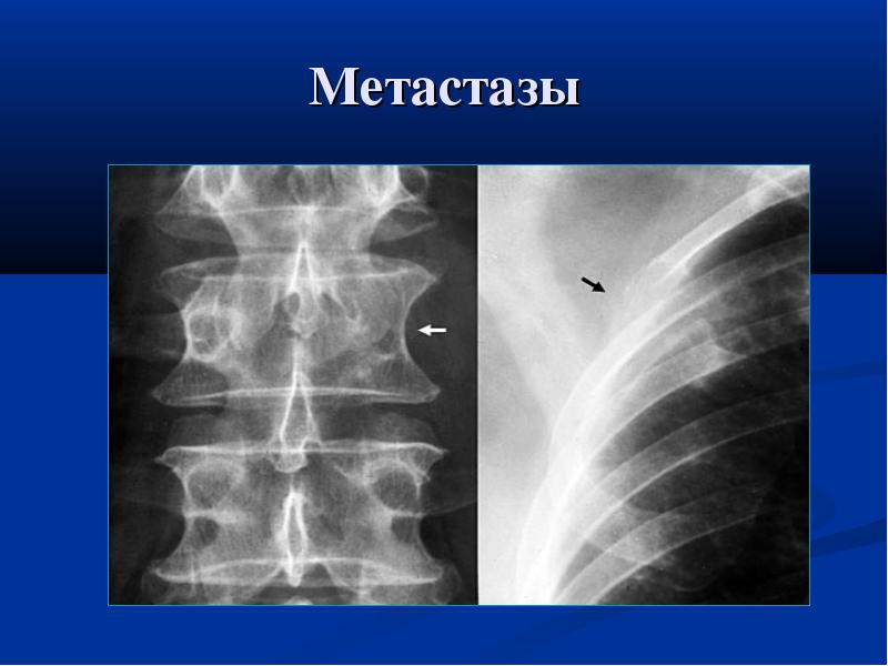 В чем опасность?