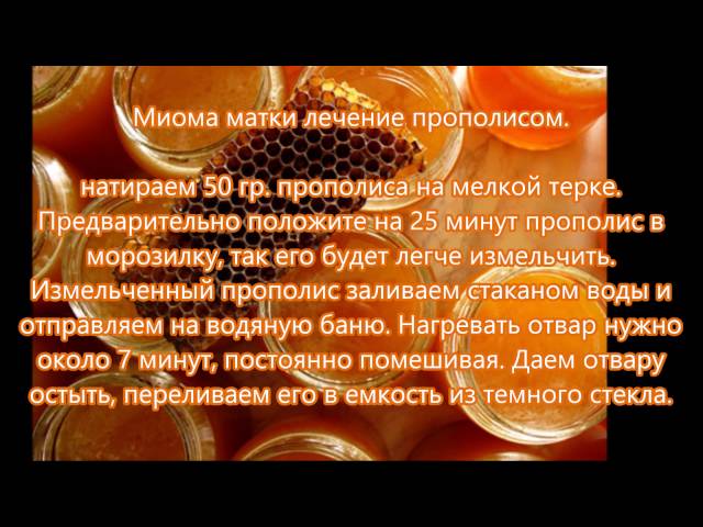 Миома.Лечение народными средствами