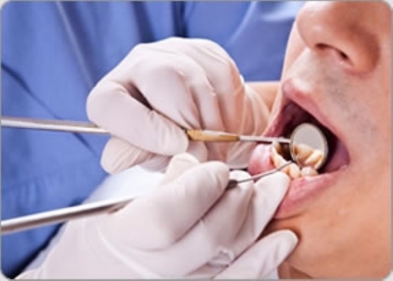 Зубная боль при периодонтите - фото 1