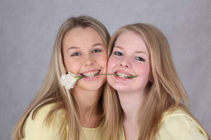 Лечение неправильного прикуса брекет-системами - фото 10