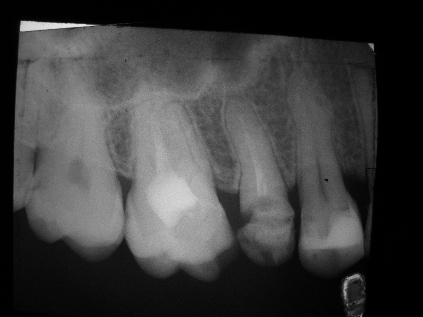 Рентген полости рта