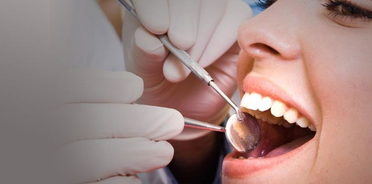 Профилактические мероприятия, позволяющие предотвратить развитие кариеса - фото 10