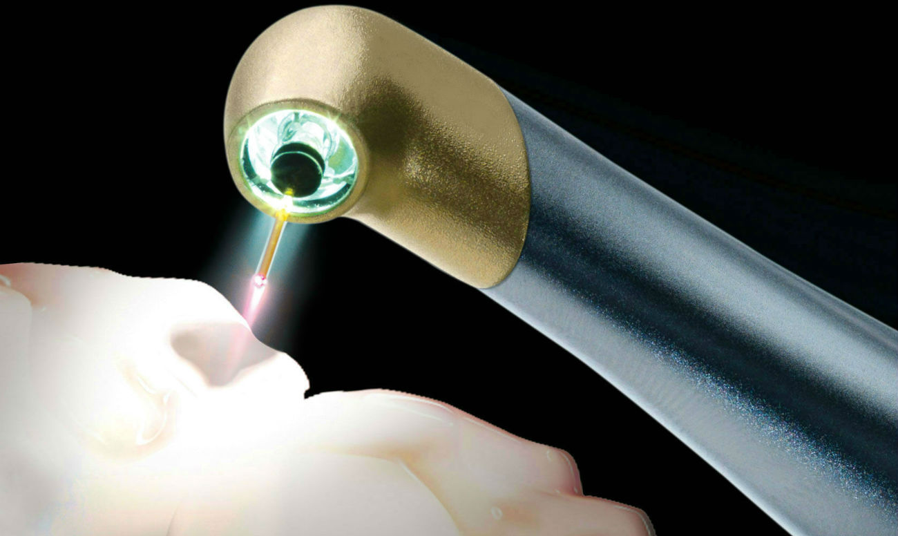 Лазерное удаление кариеса