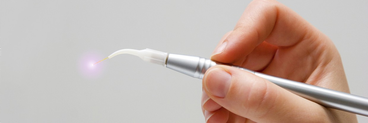 Диодный лазер