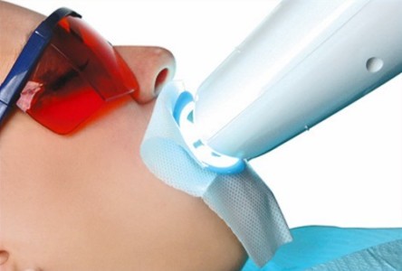 Фотоотбеливание зубов