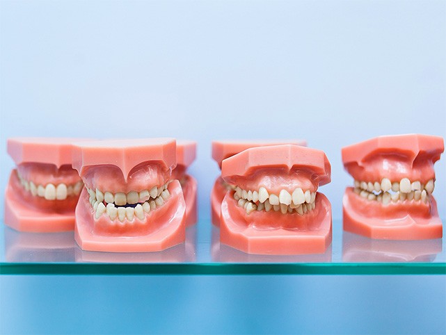 Хирургическое лечение неправильного прикуса - фото 2