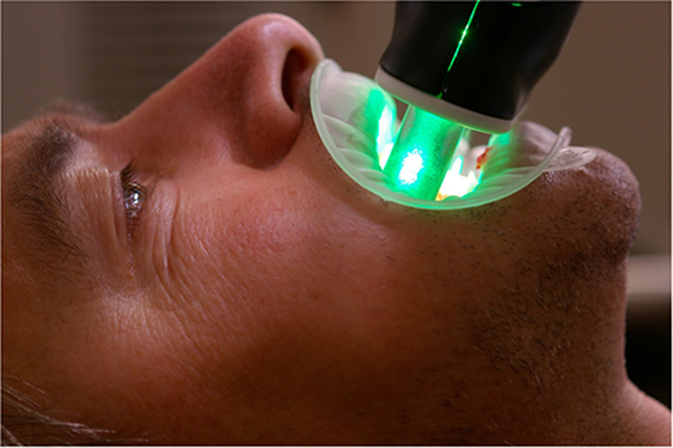 Отбеливание зубов при помощи зеленого лазера