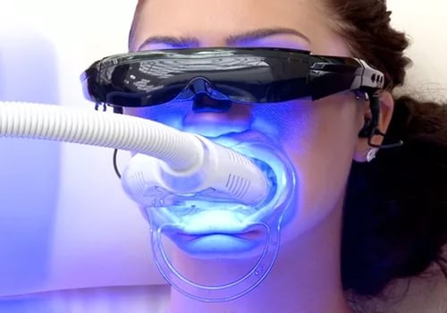 Плазменное отбеливание зубов