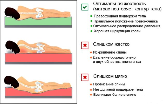 неправильная поза для сна