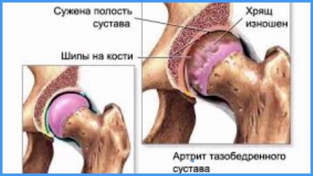 деформация сустввов